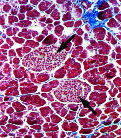 The Islets of Langerhans (photo courtesy Roche).